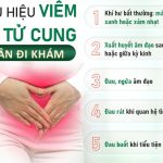 Những điều cần biết khi bị viêm cổ tử cung khi mang thai